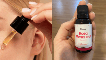 6 Benefícios incríveis o óleo de rosa mosqueta pode trazer para a sua pele que você precisa conhecer!