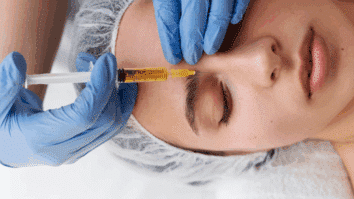 Mulher deitada em uma maca, enquanto uma dermatologista aplica PRP facial com seringa na pele do rosto